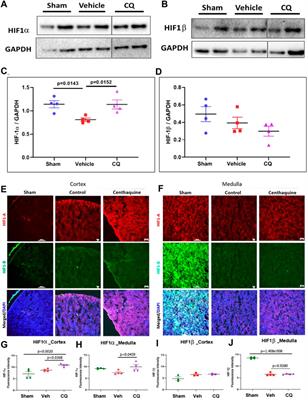 Centhaquine Restores Renal Blood Flow and Protects Tissue Damage After Hemorrhagic Shock and Renal Ischemia